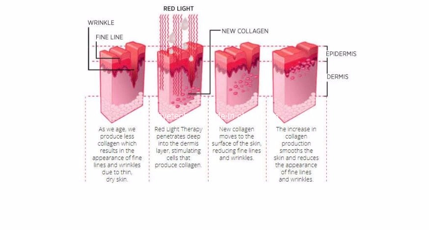 Acne Treatment LED Photodynamic Therapy PDT Light Therapy Device with 7 Colors Wrinkle Removal Device