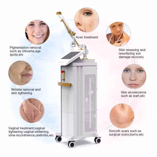80W Fractional CO2 Laser Machine Skin Resurfaçage Machine Acne Scar Removal CO2 Fractional Laser Device